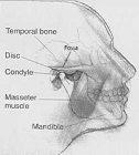 Causes of TMJ DISORDERS