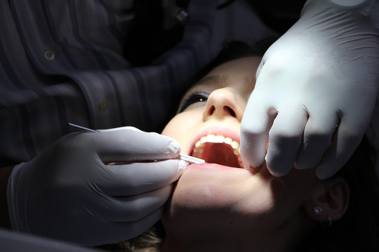 Broken Tooth Treatment Bala Cynwyd