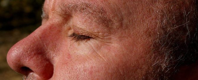 Wrinkles Treatment Bala Cynwyd