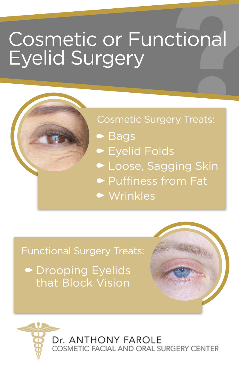 Cosmetic or Functional Eyelid Surgery Bala Cynwyd