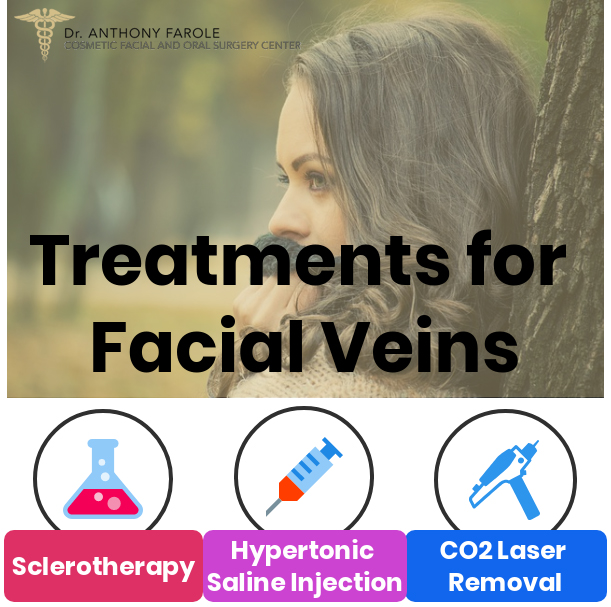 Treatments for Facial Veins