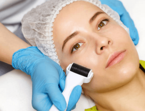 At What Age Should You Get RF Microneedling