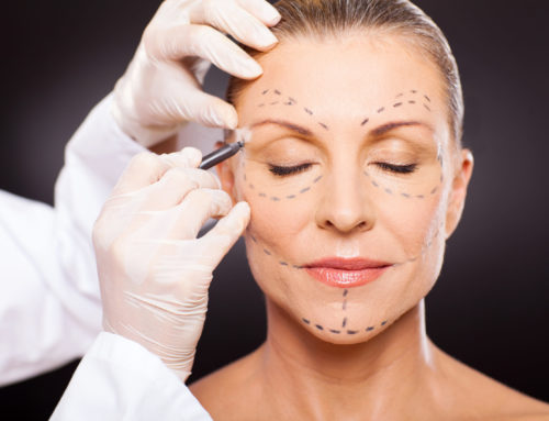 What is the Average Cost for a Facelift?