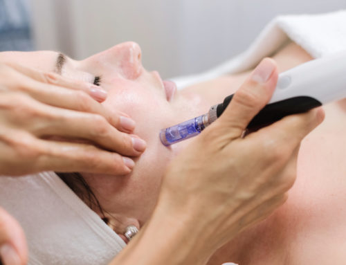 Fractional RF Microneedling: 3 Tips For Post-Treatment Care